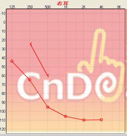 .png
