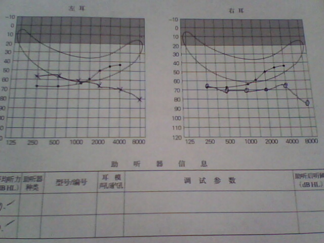 4_213090_0ec5e2df14af1e5.jpg