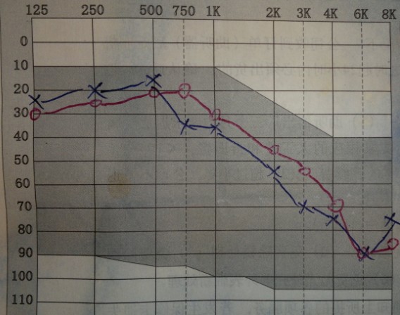 (Oct 13,2008)Hearing chart.jpg