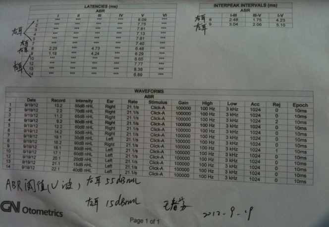 evoked potential report2
