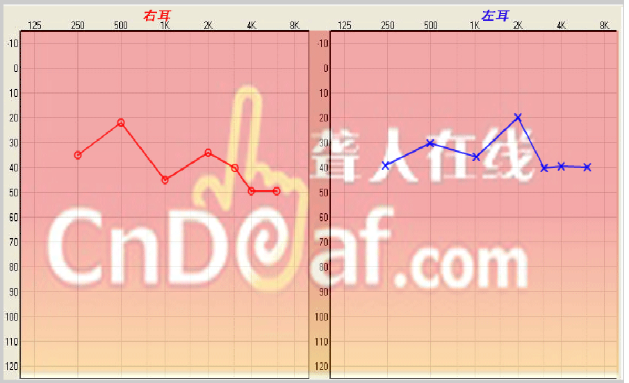 ͼ.png
