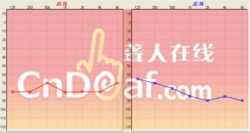 K`DC%S{M7VJL~YI@(L9X}%0.jpg