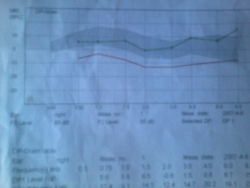DOAPE1