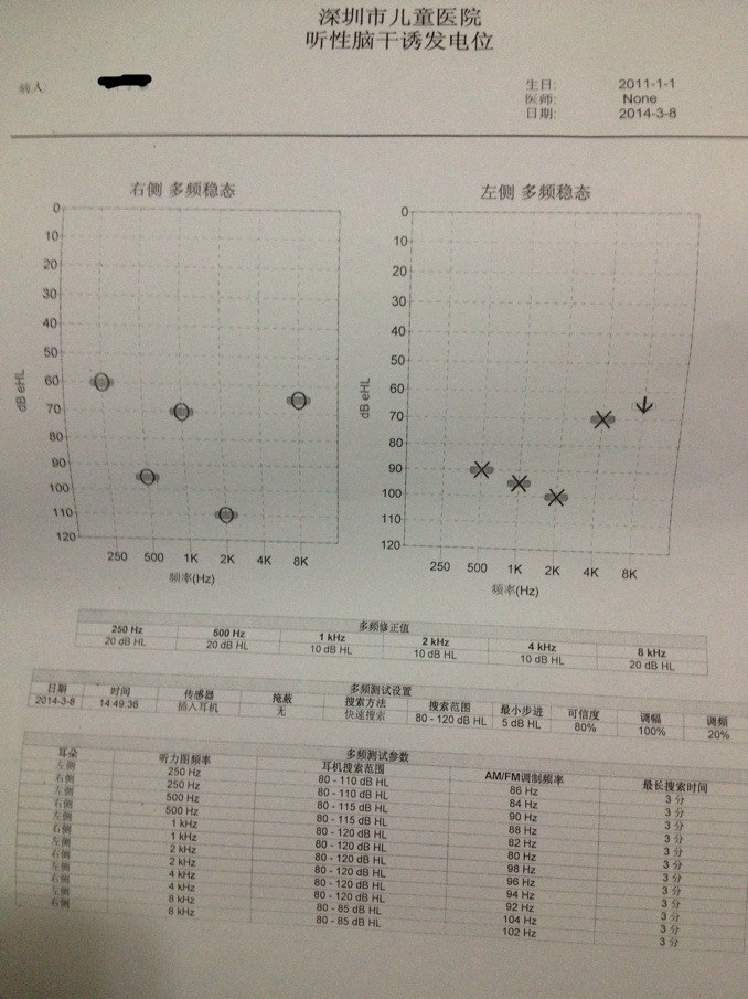 ASSR2.jpg