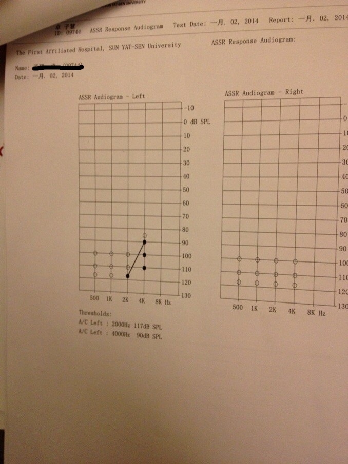 ASSR.jpg