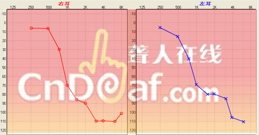 QQͼ20141017221657.png
