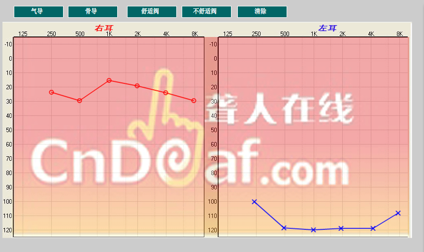 QQͼ20141115222128.png