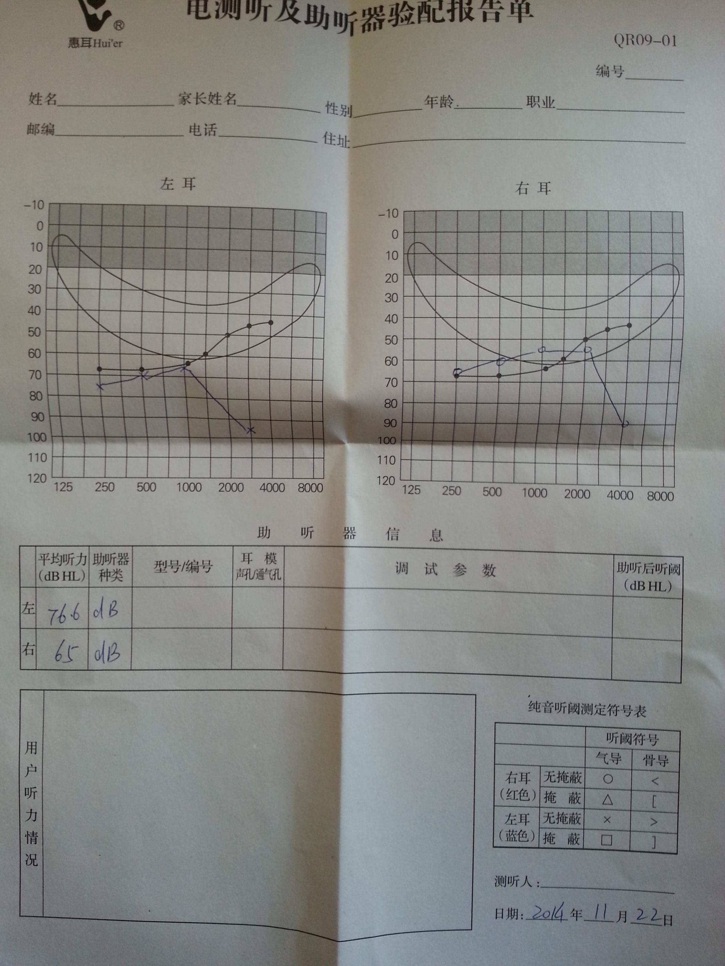 20141122_112039.jpg