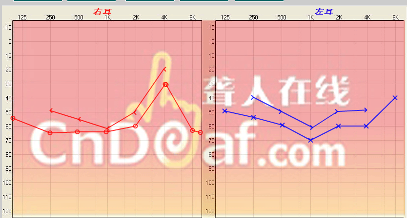 QQͼƬ20141210172338.png