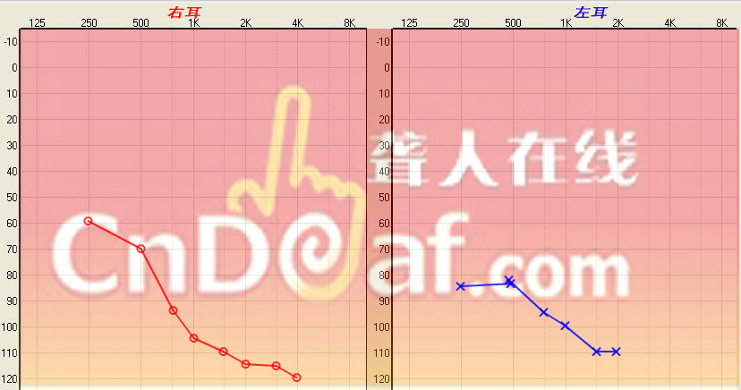 ͼ20141201.png