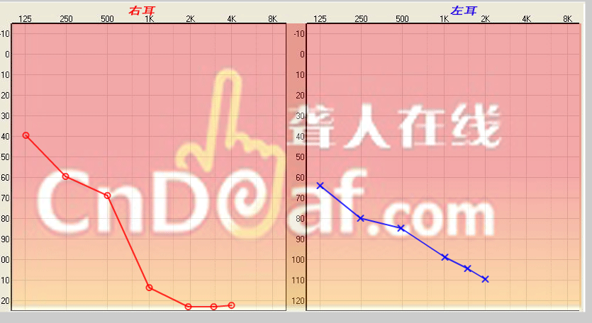 ͼ20141202.png